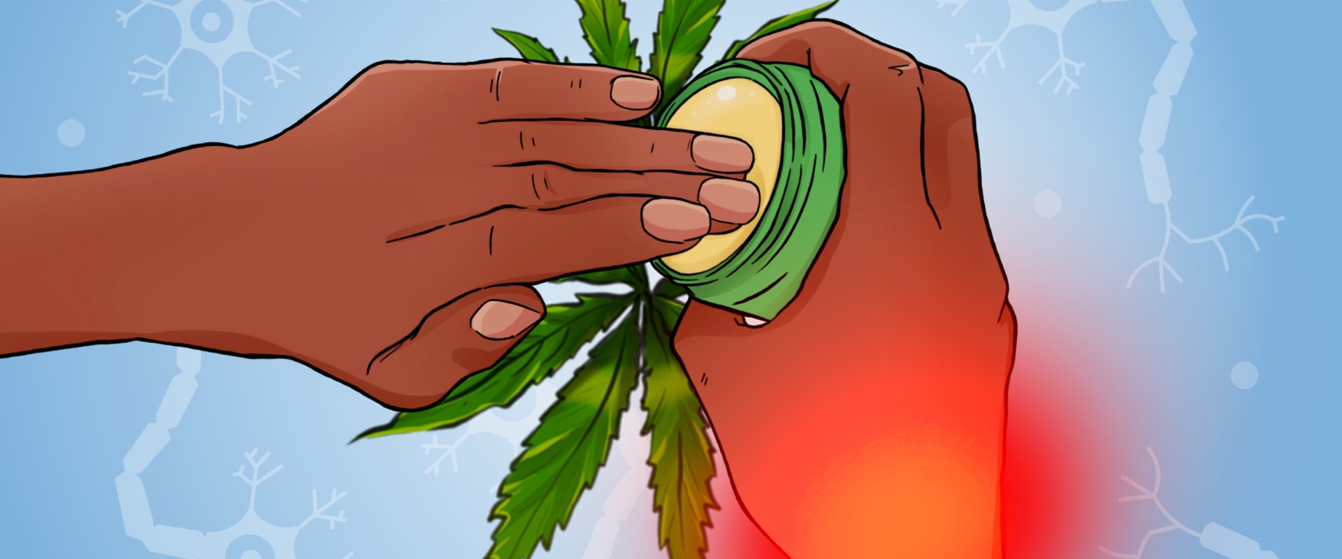 Managing Nerve Pain with Cannabis