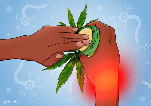 Managing Nerve Pain with Cannabis